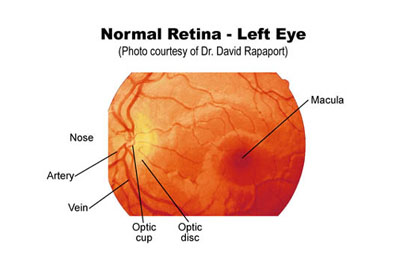 retinaD